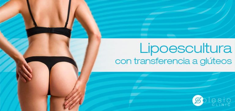 Lipoescultura Con Transferencia A Gl Teos Mediante Grasa Extra Da