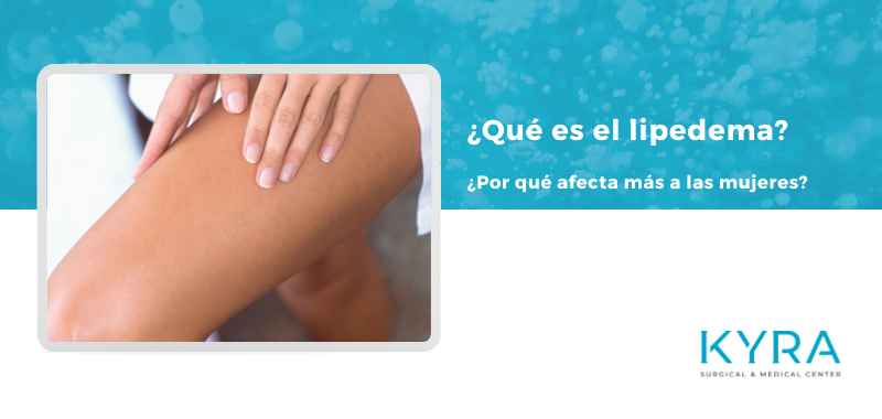 Lipedema en Alicante. Por qué afecta a las mujeres