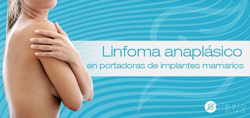 linfoma anaplásico en mujeres con prótesis mamarias
