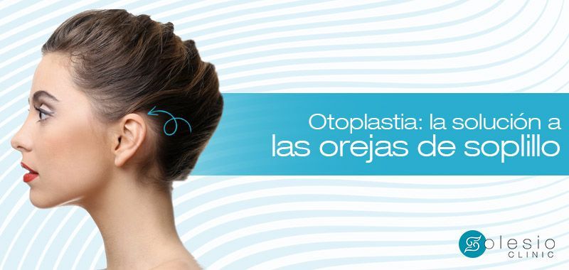 orejas de soplillo solución otoplastia Alicante doctor Solesio