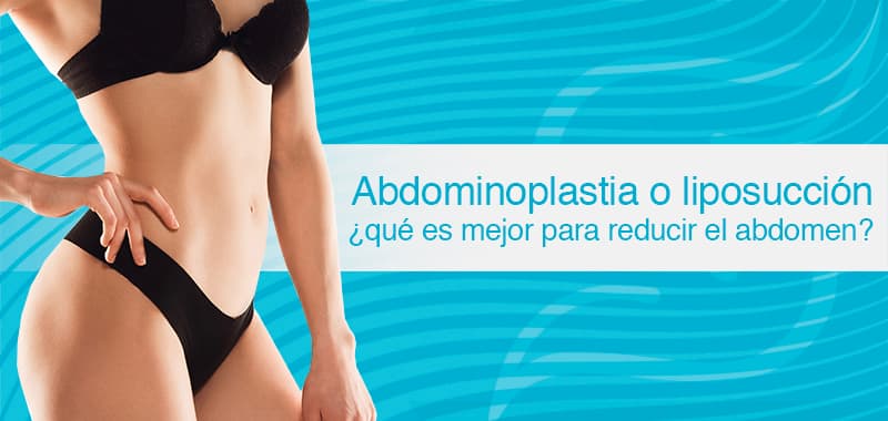 reducir el abdomen: abdominoplastia o liposucción